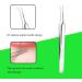 5-in-1 Blackhead Remover Tool Kit | Stainless Steel Pimple Popper Extractor for Face | Includes 4 Tweezers | Professional Blackhead Removal Tool - 0414041 - Buy Online on GoSupps.com