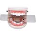 Buy Spuzzo 4-Piece Dental Orthodontic Intraoral Reflector Mirror Set - Dual-Sided Photography & Occlusion Mirrors for Professionals - International Shipping Available - Buy Online on GoSupps.com
