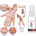 Vitiligo Removal Relief Spray - Reduces White Spots on Skin - 3pcs - Buy Online on GoSupps.com
