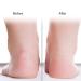 Silicone Moisturizing Gel Socks for Dry Feet & Cracked Heels Foot-Anti-Riss Protection (Pink L) | International Shipping - Buy Online on GoSupps.com