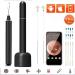 QIYUDS Wireless Ear Wax Remover with 1080P HD Endoscope - Black | For iPhone, iPad, Android - Buy Online on GoSupps.com