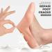 Moisturizing Silicone Gel Socks | Reusable Soft Heel Cushion Sleeve Protector for Ultimate Comfort - Buy Online on GoSupps.com