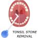 Hiessgozy Tonsillenstein Removal Tool - Right-Angled Long Pipe Glass Cleaner for Effective Mouth Tone Silence Suction | Manual PVC Cleaner - 1 PCC - Buy Online on GoSupps.com