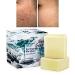 2 PK- ONIYEA Sea Salt Soap 3.5 Oz Each, Exfoliating Acne Deeply Clean Problem Skin, Natural Goat's Milk, All Skin Types, Face Wash Body Wash Skincare, Women Men Gift