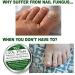Dr. Coles Organic Nail Fungus Treatment - Extra Strength Herbal Anti-Fungal Solution for Nails | Disinfects, Repairs & Safe for Family - Buy Online on GoSupps.com