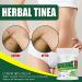 Herbal Tinea Corporis Cream - Gentle Skin Relief Itching Ointment | Non-irritating Antipruritic Formula (1pcs) - Buy Online on GoSupps.com
