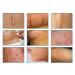 Silicone Scar Sheets | Medical Grade Clear Gel Strips for Surgical Scars | C-Section, Breast, Burn, Keloid, Acne | 6cm x 15cm | Scar Tape for Effective Scar Removal - Buy Online on GoSupps.com