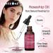 Rosehip Oil for Face Certified Organic Rosehip Oil use of Scars Stretch Marks Fine lines adn Wrinkes 10ml - Buy Online on GoSupps.com