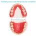 Denture Fake Teeth - Do it Yourself Full or Part Top and Bottom Fake Teeth at Home Repair Missing Teeth Improve Smile(Gypsum Model Gum Material and Fake Teeth) - Buy Online on GoSupps.com