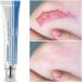  ZRREMRE Anti Scar Cream Repair Gel for Old and New Scars Face Scar Treatment Cream Surgical Scars Acne Scars Caesarean Section  - Buy Online on GoSupps.com