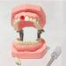 Ernzi dentures model - removable typodont teeth model - removable teeth - dental preparation practice - for study lessons