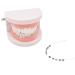 Angzhili Temporary Tooth Decoration Practice Props with Metal Bracket, Wires, and Ligature Ties - Buy Online on GoSupps.com