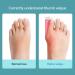 Keenso 2pcs Bunion Corrector & Toe Separators for Women - Universal Female Toe Splints for Overlapping Big Toe - Buy Online on GoSupps.com