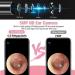 Wireless Otoscope with Camera for Ear Wax Removal - 1080P WiFi Ear Cleaner for iOS Android - Visual Ear Endoscope for Adults, Kids & Pets - Pink - Buy Online on GoSupps.com