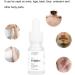 Sonew 10ml Hair Growth Inhibitor Serum | Permanent Anti-Ingrown Solution for Men & Women | Moisturizing Post Shave Gel with Plant Extracts - Buy Online on GoSupps.com