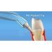 Waterpik Pik Pocket Tips Pro PP-100E | 2 Pack (3 Pack) - Best Oral Care Solution for Healthier Gums | International Shipping - Buy Online on GoSupps.com