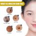 (Must - Have) Super Luxe Skin Re_mover Super Luxe Skin Re_moval Skin Tag Re_mover Cream Painless Mole and Skin Re_mover for All Skin Types (2PC) - Buy Online on GoSupps.com