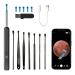 Lomug ear wax removal Otoscope 16PC EAR Cleaning kit with 5 replacement heads WiFi ear cleaner camera with 6 LEDs 1920p 20mm focal length ear endoscope for Android iOS Harmony OS (black)