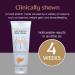 Stretch Marks Removal Cream | Safe for Pregnancy | Dermatologically Tested | All Skin Types | 100g - Buy Online on GoSupps.com