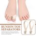 FRCOLOR Bunion Toe Separator - Orthopaedic Bunion Splint for Hallux Valgus Correction - Day Night Support, 2 Pieces, Size 35-40 - Buy Online on GoSupps.com