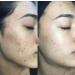 NU Renu Toner - Niacinamide Facial Toner for Hyperpigmentation & Enlarged Pores | 3.38 fl. Oz - Shop Internationally - Buy Online on GoSupps.com