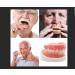 DIY Denture Fake Teeth Set - Top and Bottom Temporary Teeth for Instantly Improving Your Smile - Buy Online on GoSupps.com