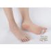 Soft Silicone Orthopedic Metatarsal Rings - Hammer Toe Gel Separator & Cushion Pads for Pain Relief - Buy Online on GoSupps.com
