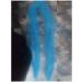 Buy African Net Sponge - Natural Exfoliating Bath Sponge for All Skin Types | International Shipping Available - Buy Online on GoSupps.com