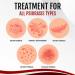 Dermax Psoriasis Treatment Spray 30ml - Soothe Skin, 5 Pack - Buy Online on GoSupps.com