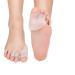 Gel Toe Separator  Gel Toe Separators Spreaders Straighteners  Bunion Corrector Toe Separator Gel Spacers  Hammer Toe Straightener for Women & Men Hallux Valgus Correction