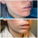 Avene Cicalfate Repair Cream Hypoallergenic for Sensitive & Irritated Skin 100 ml - Buy Online on GoSupps.com