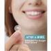 Acne Pimple Patch Master Patch - 144 Hydrocolloid Dots for Effective Blemish Treatment | International Shipping Available - Buy Online on GoSupps.com
