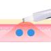 Qukaim Facial Pore Spatula Face Skin Scrubber Spatula Deep Cleansing Beauty Lifting Tool for Daily Facial Treatment Travel-Friendly Home Skincare Gadget - Buy Online on GoSupps.com
