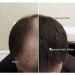 Medium Brown Hair Loss Fibers 50g - XL Size Samson Concealer Refill | Best Match for All Brands - Buy Online on GoSupps.com