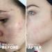 Dew Drops Hyaluronic Acid & Vitamin C Serum - Vegan Facial Serum - Brightening & Plumping - 1 Fl Oz - Buy Online on GoSupps.com