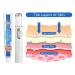 Veinhealth Blue Light Therapy Set for Varicose Veins - Effective Treatment Cream for Legs - Buy Online on GoSupps.com