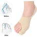 LTLCLZ 2Pcs Big Toe Protector/Corrector Pedicure Socks for Bunions & Hallux Valgus - Orthopedic Foot Care - Buy Online on GoSupps.com