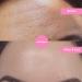 Notox Forehead + Frown Lines - Nudie Face - 100% Medical Grade Silicone Wrinkle Patch - Reusable Silicone Face Patch To Reduce Fine Lines and Wrinkles - Wrinkle Smoothing - Fast Results - Buy Online on GoSupps.com