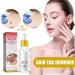 (Must - Have) Super Luxe Skin Re_mover Super Luxe Skin Re_moval Skin Tag Re_mover Cream Painless Mole and Skin Re_mover for All Skin Types (2PC) - Buy Online on GoSupps.com