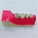 Croix Dentaire Molar Section | Oral Simulation Teeth Model for Dental Study | Educational Dental Model with Nerve Line for Tissue Dissection - Buy Online on GoSupps.com