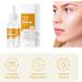 Kojic Acid Turmeric Oil Turmeric Oil Dark Spot Corrector Turmeric Face Serum Turmeric Dark Spot Corrector Serum Oil Turmeric Skin Brightening Oil Dark Spot Remover for Face Anti Aging Face Serum 100ml - Buy Online on GoSupps.com
