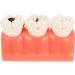 Ultechnovo 2PCS Pathological Teeth Display Model for Dental Training - Endodontic Caries Tool 12.5x7x6.5cm - Ideal for Dentists & Students - Buy Online on GoSupps.com