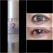 Advanced Anti-Aging Eye Treatment Serum for Rapid Reduction of Under-Eye Bags, Wrinkles, and Fine Lines - Brightening Formula with Niacinamide and Hyaluronic Acid - Buy Online on GoSupps.com