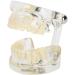 Transparent Removable Tooth Model for Teaching - Easy to Use Synthetic Resin Dental Practice Tool - Buy Online on GoSupps.com