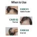 Dashu Anti-Hair Loss Herb Tonic | 150ml Hair Growth Solution - Buy Online on GoSupps.com