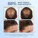 Bosley Bos-Revive Thickening Treatment for Non Color-Treated Hair - 6.8 fl oz (200 ml) - Buy Online on GoSupps.com