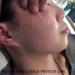 Fils de Soie de collag ne pour Fil de Soie Lifting de Fil de Soie pour Le resserrement de la Peau collag ne Actif pour Le Visage Fils de Soie Lifting et renforcent efficacement la Peau du Visage - Buy Online on GoSupps.com
