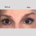 Instant Browlifts - Eyebrow Lift Strips & Anti-Wrinkle Tape | 30-Day Supply for Perfect Brows - Buy Online on GoSupps.com