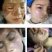 2024 Rejuvenating Honey Peel-Off Mask | Anti-Aging Nourishing & Muscle Tearing Solution - Buy Online on GoSupps.com
