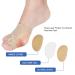 Hallux Valgus Correction Toe Spreader | Gel-Pad Comfort for Bunion Relief | International Shipping Available - Buy Online on GoSupps.com